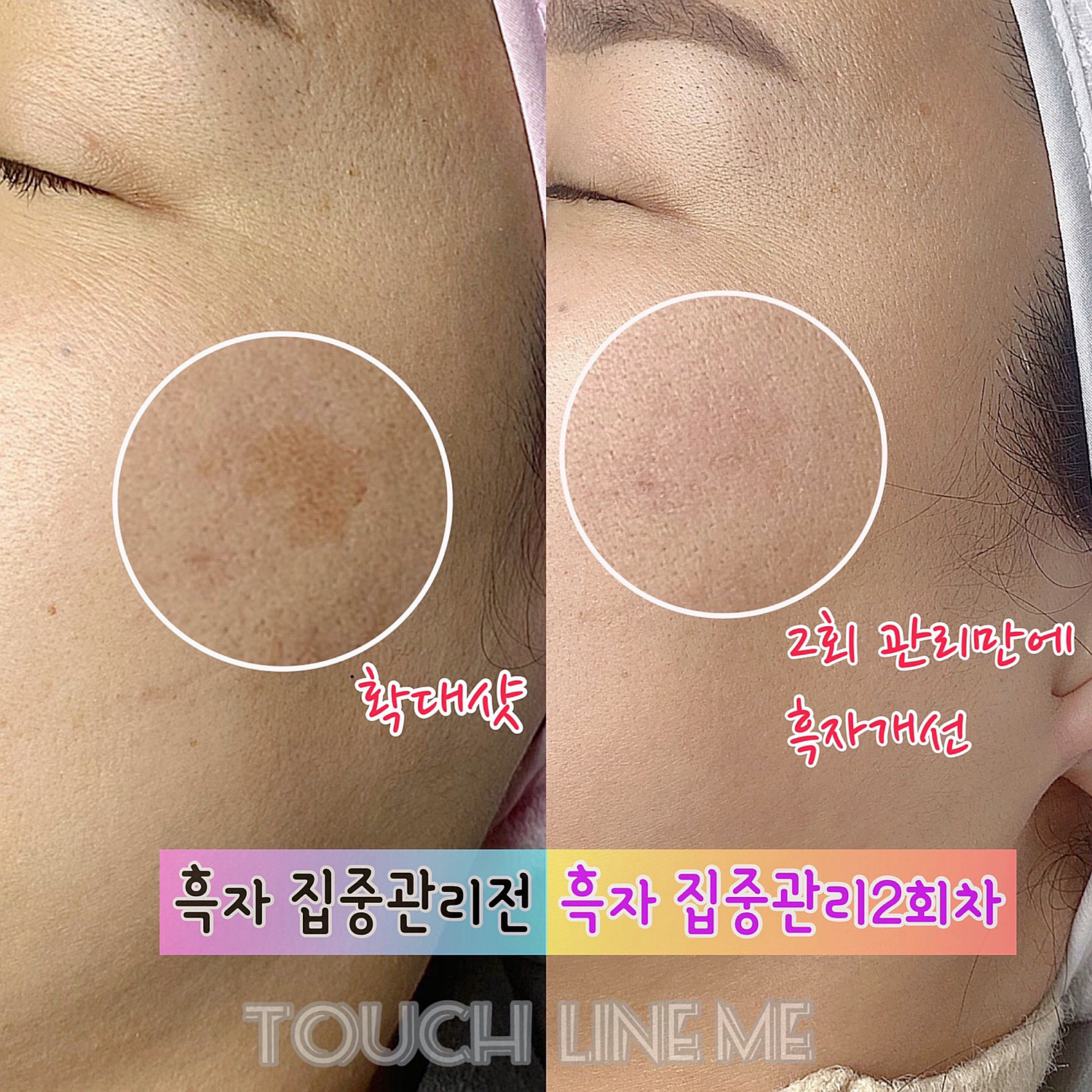 터치라인미
