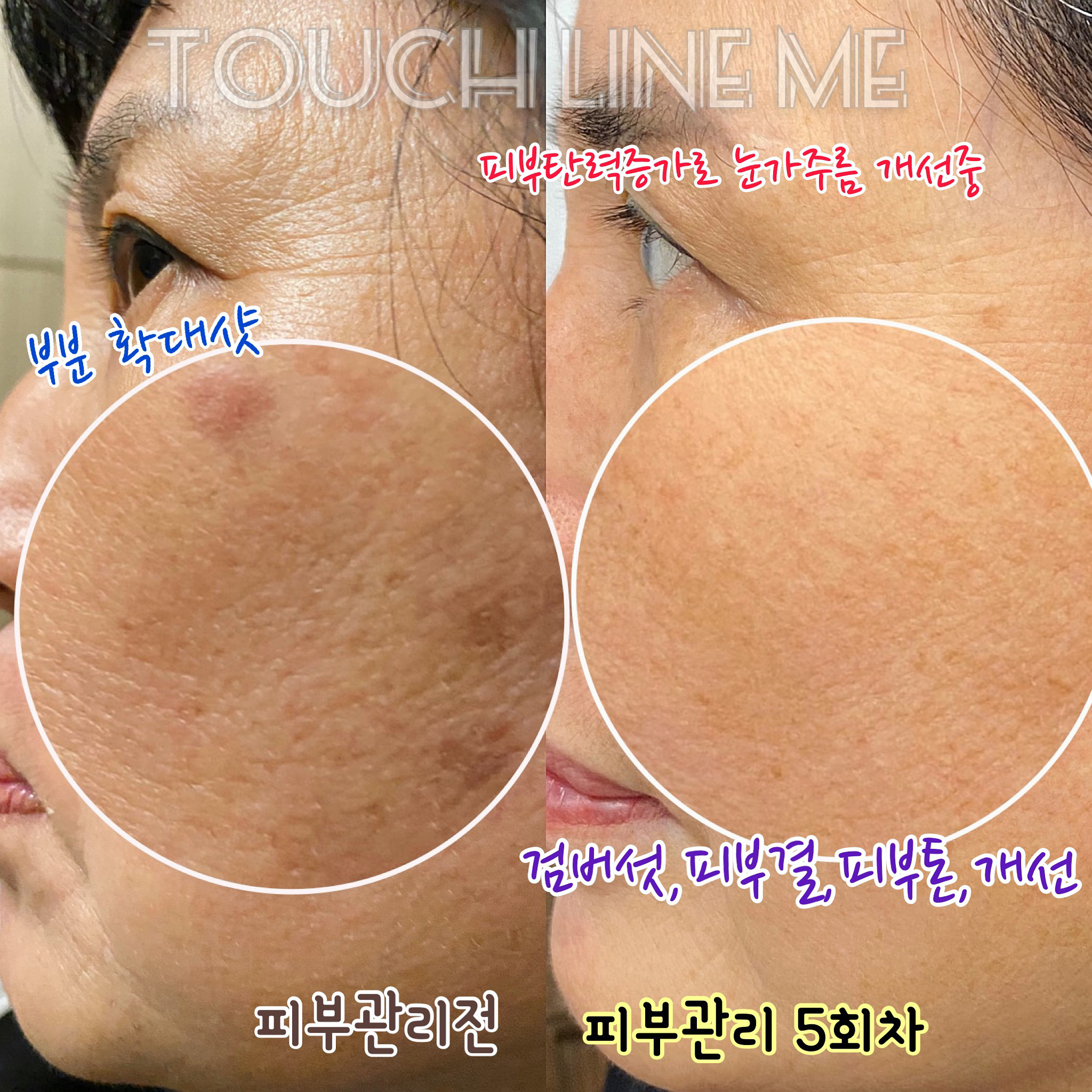 터치라인미