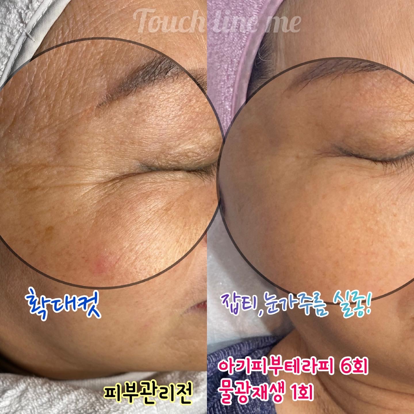 터치라인미