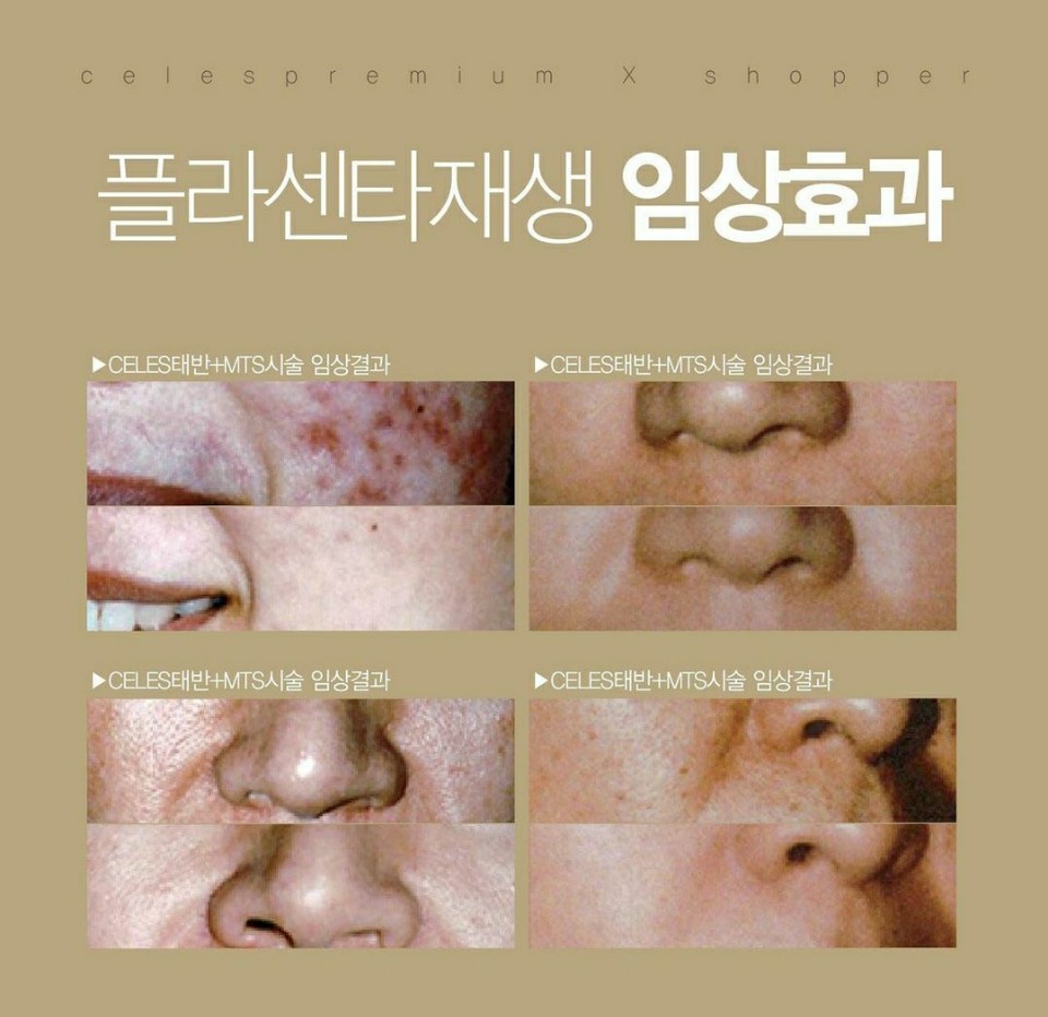 터치라인미