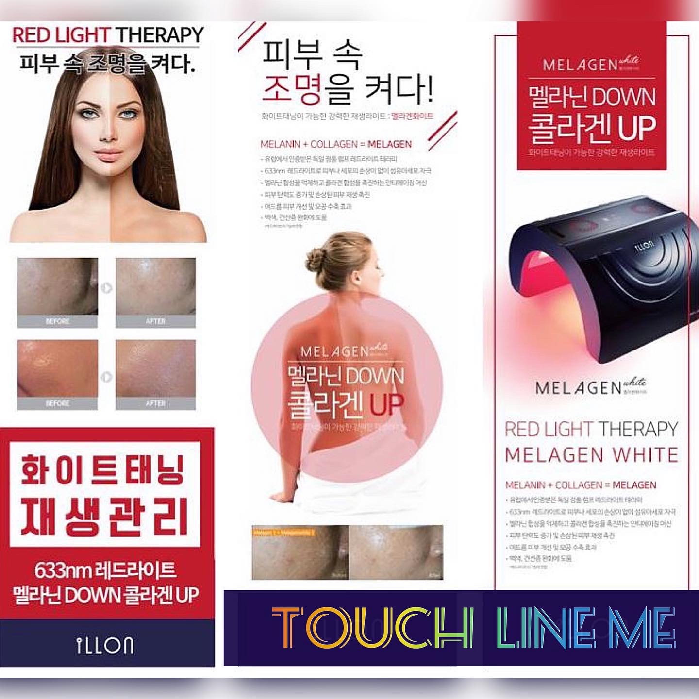 터치라인미