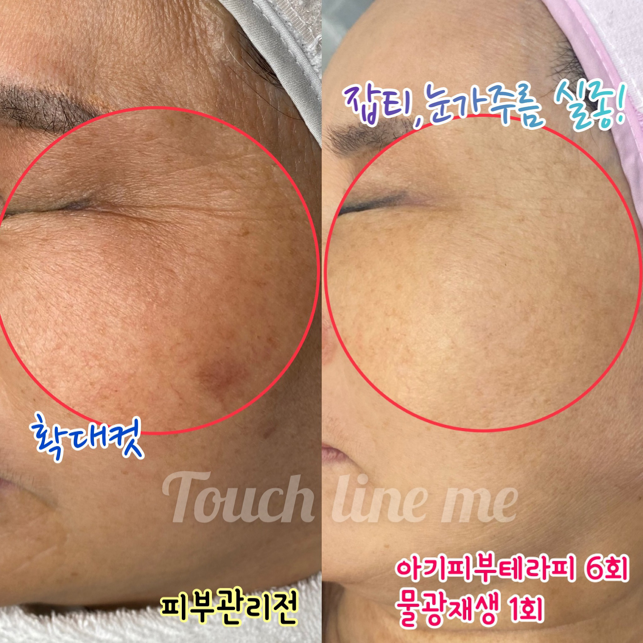 터치라인미