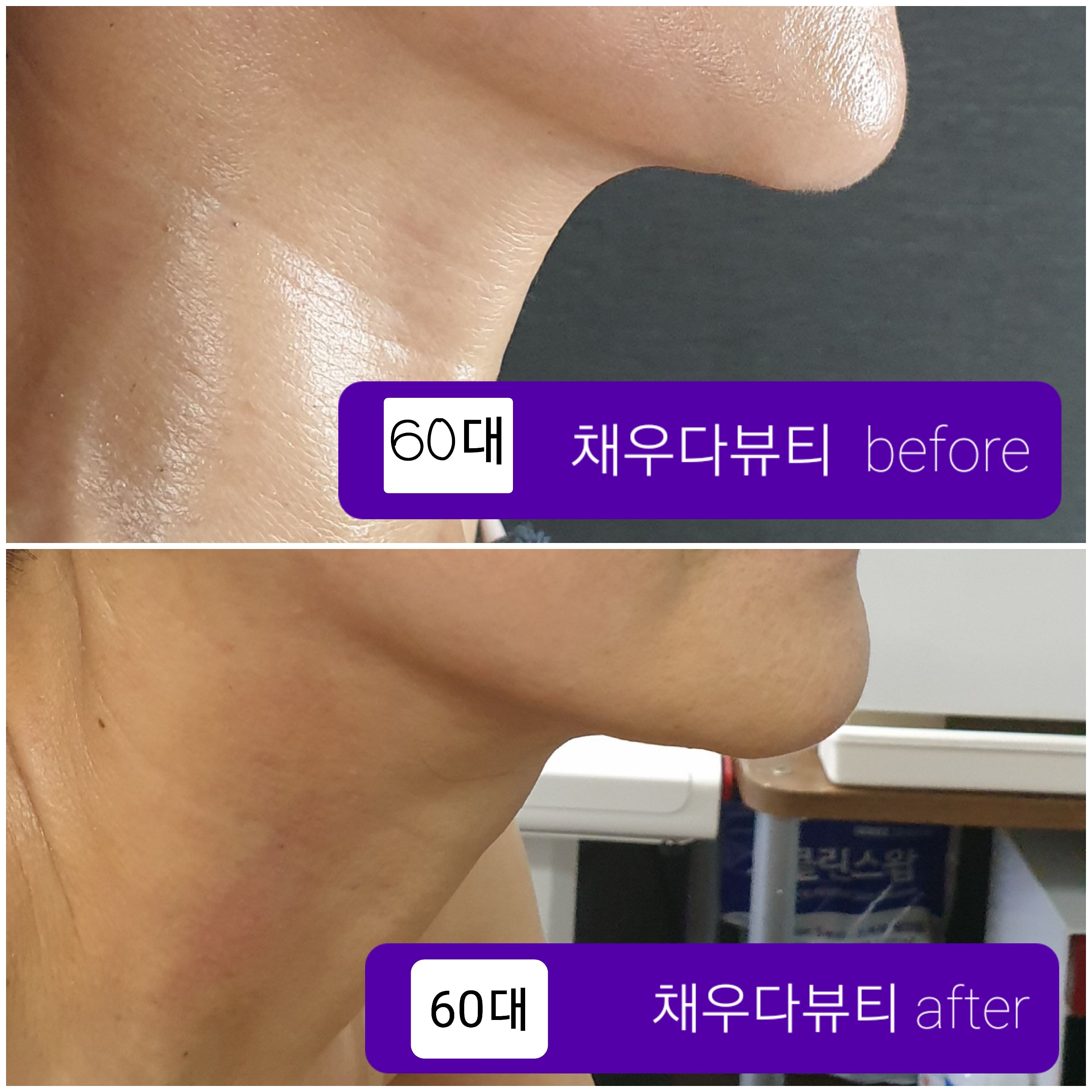 채우다뷰티