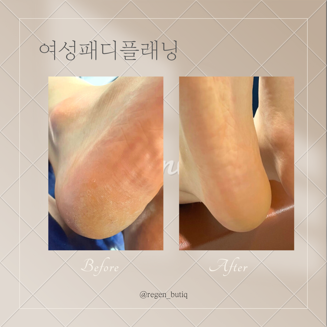 리젠왁싱&스킨케어