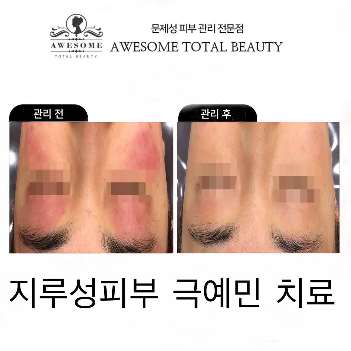 어썸뷰티에스테틱 대표 이미지