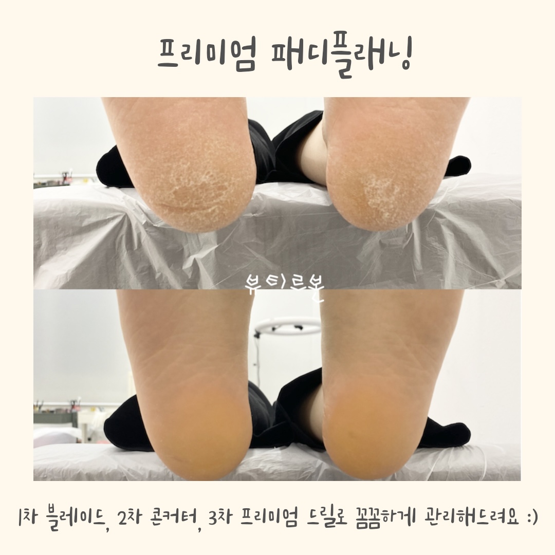뷰티르본