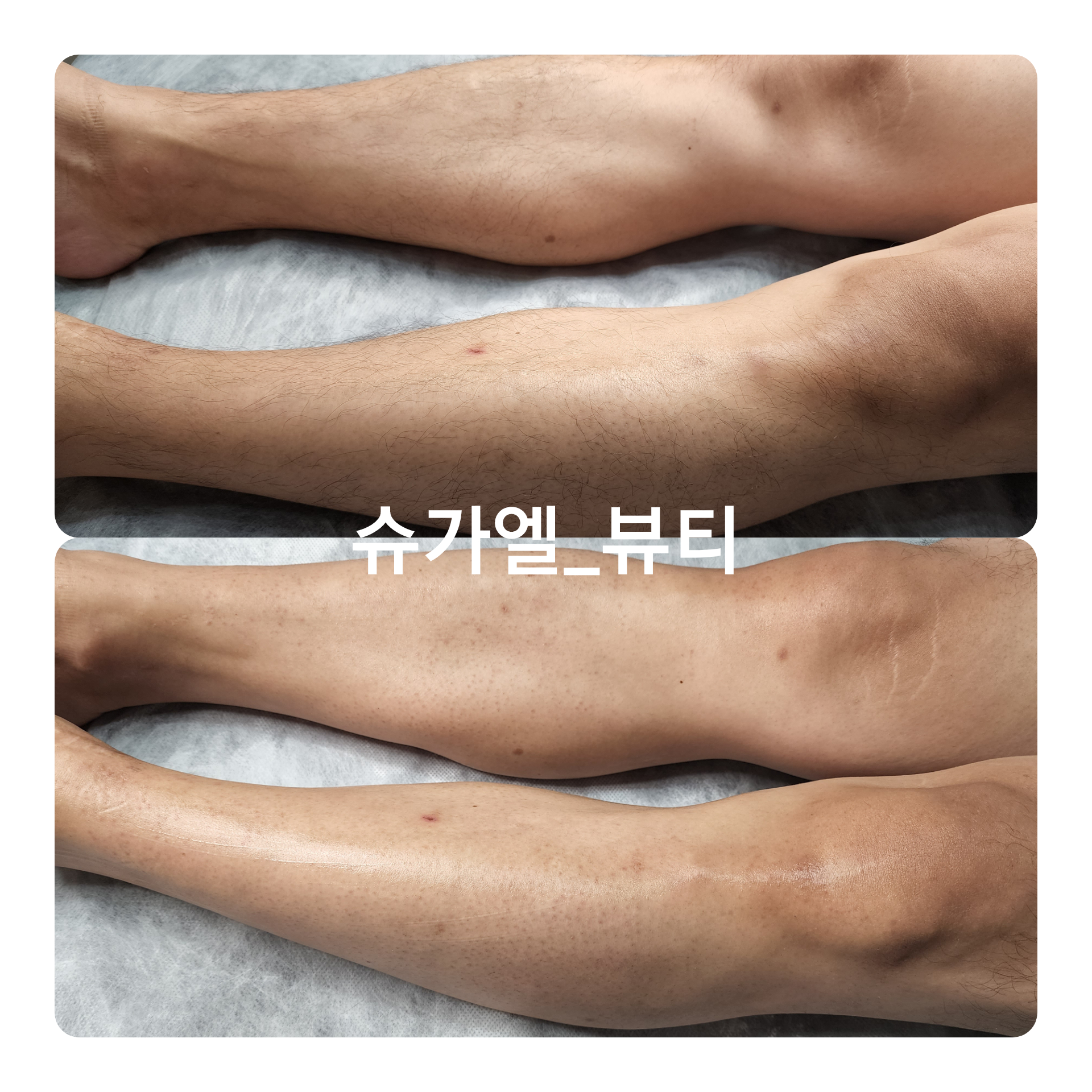슈가엘뷰티 슈가링왁싱 민락점