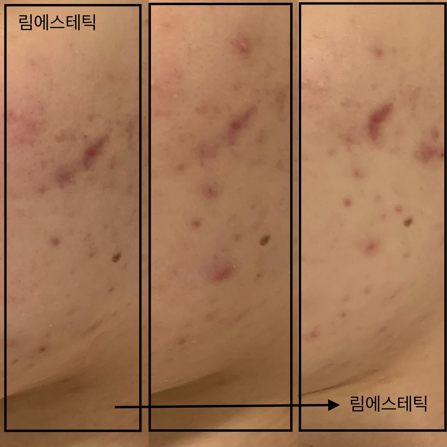 림에스테틱