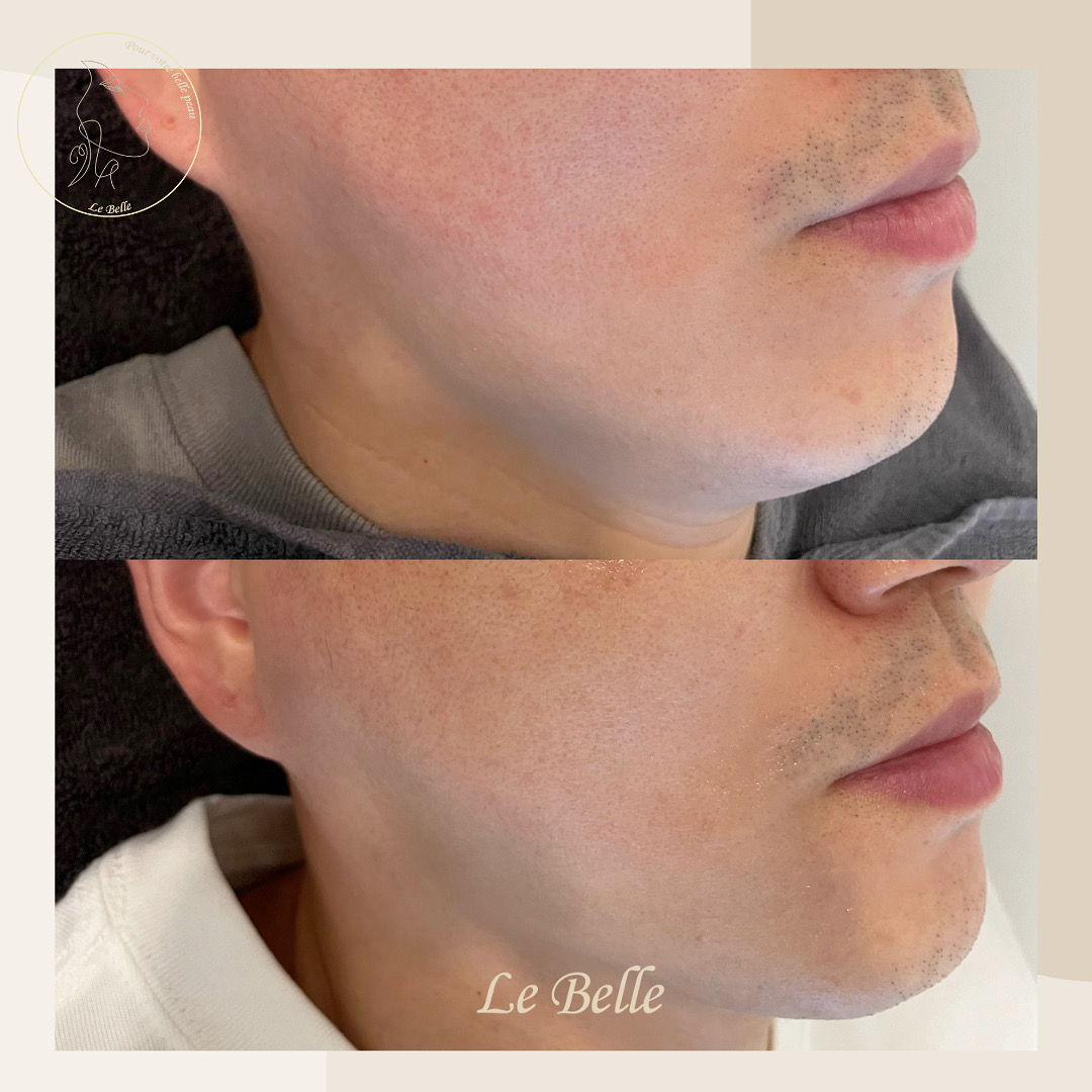 르벨에스테틱 대표 이미지