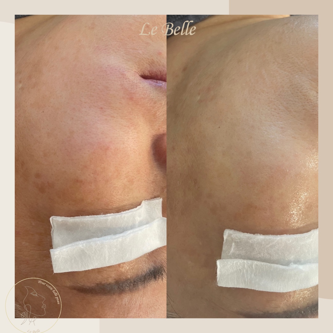 르벨에스테틱 대표 이미지