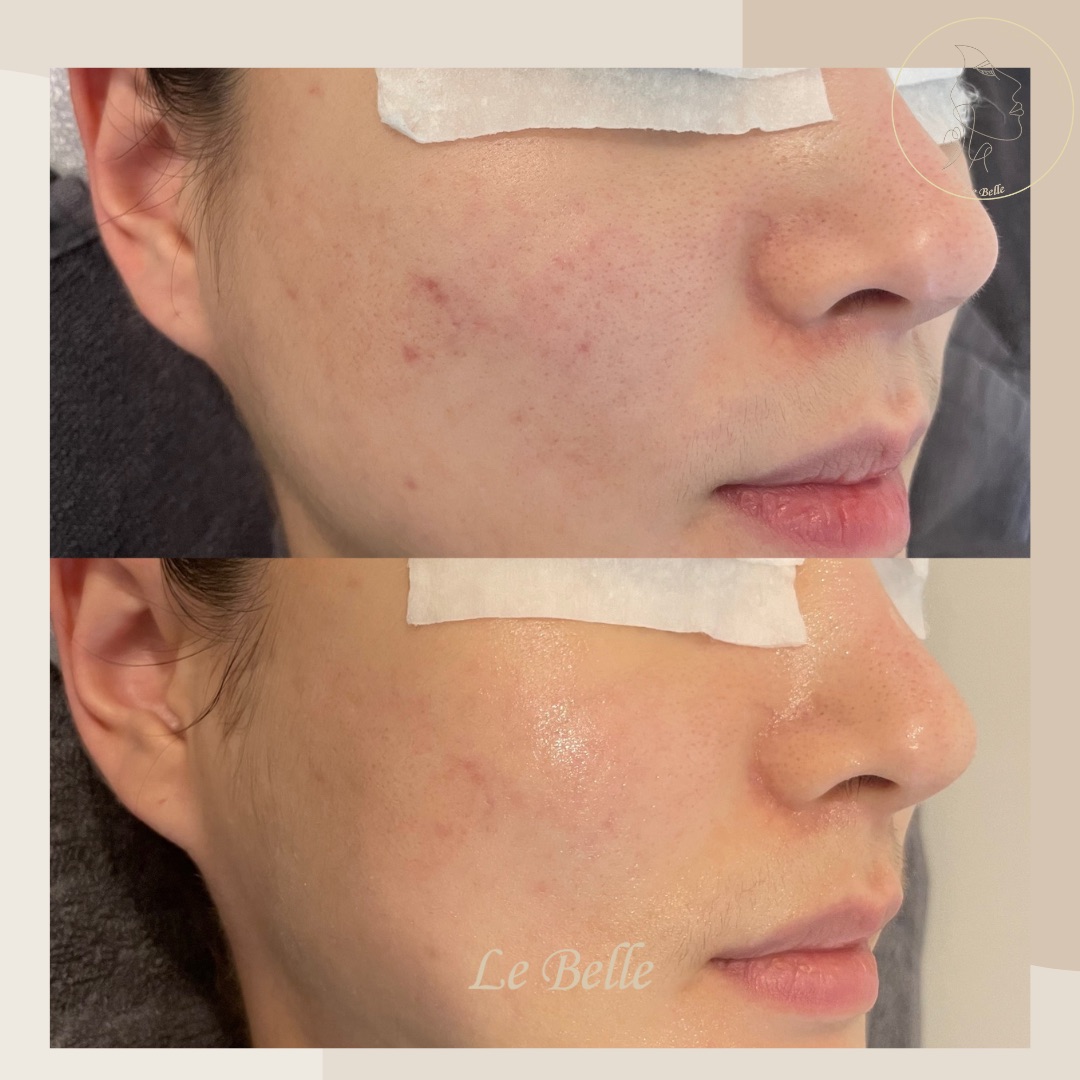 르벨에스테틱 대표 이미지