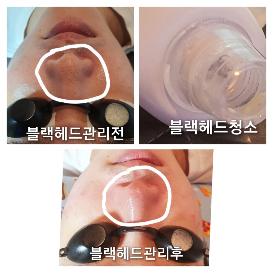 서울대입구역피부관리뷰티끄라인 대표 이미지
