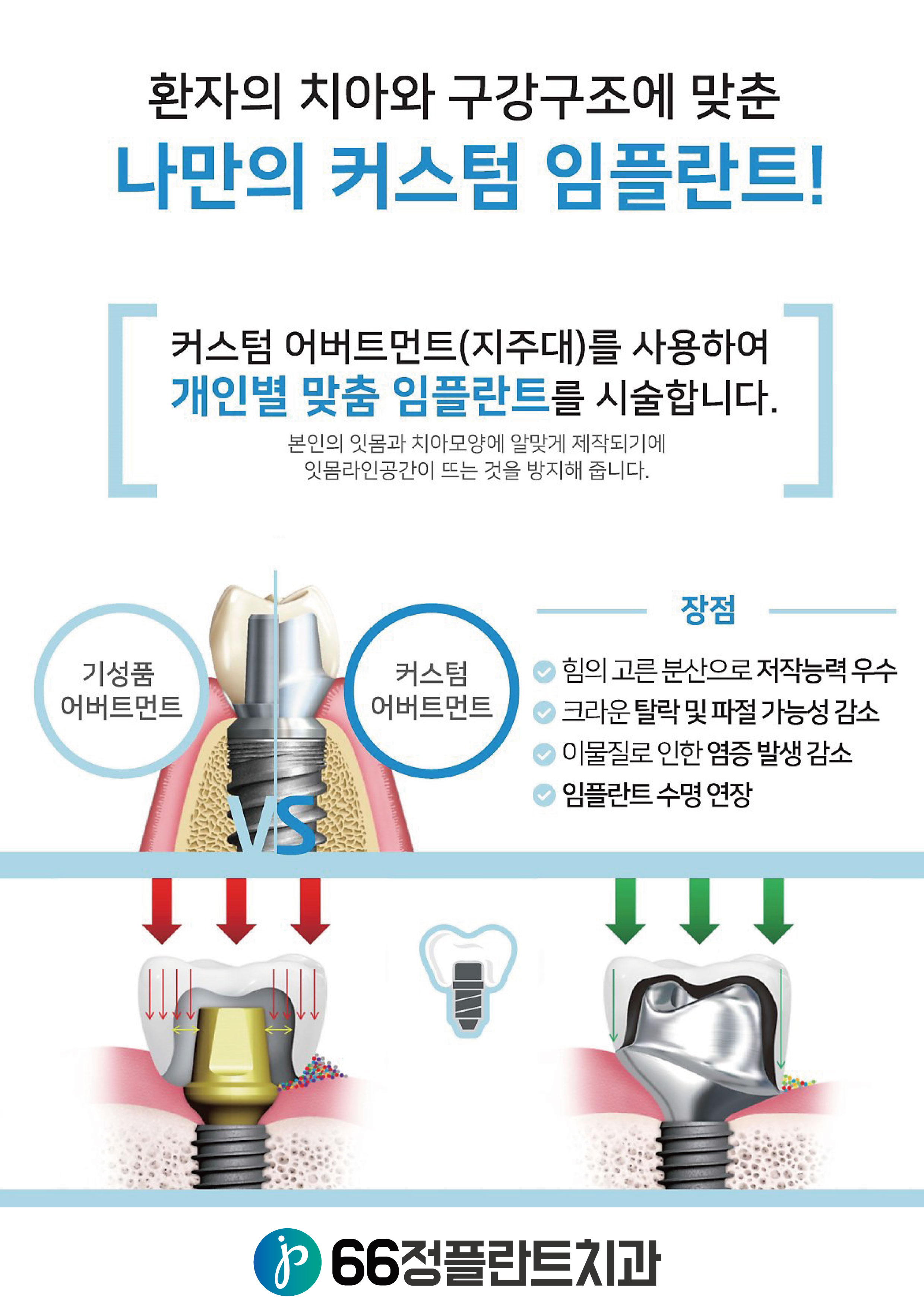 66정플란트치과의원