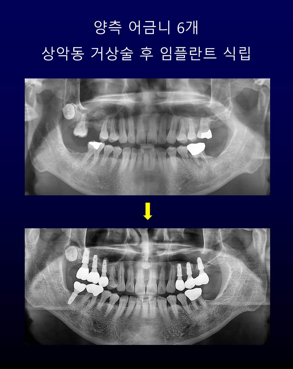 비와이씨디지털치과의원