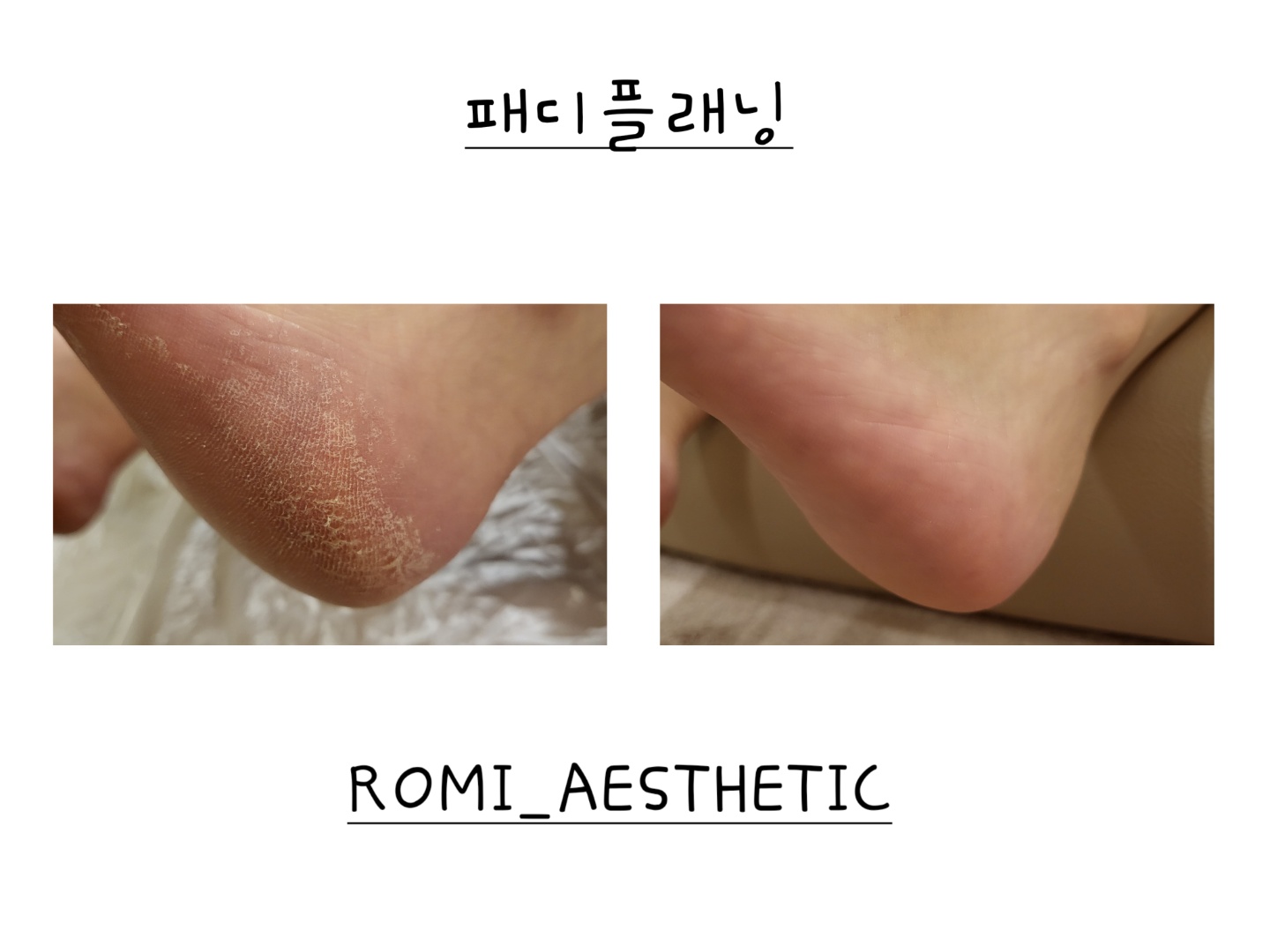 로미에스테틱