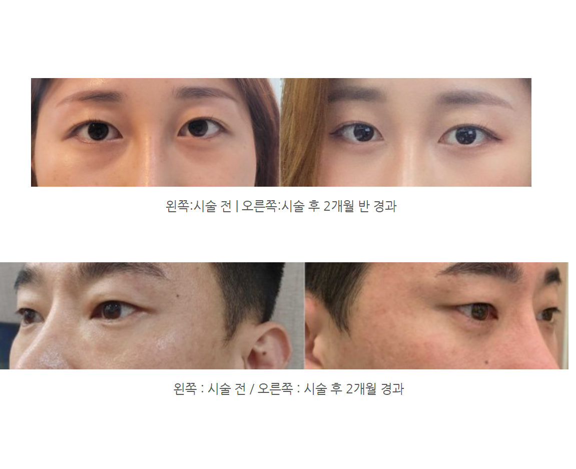 도곡 유스앤영의원