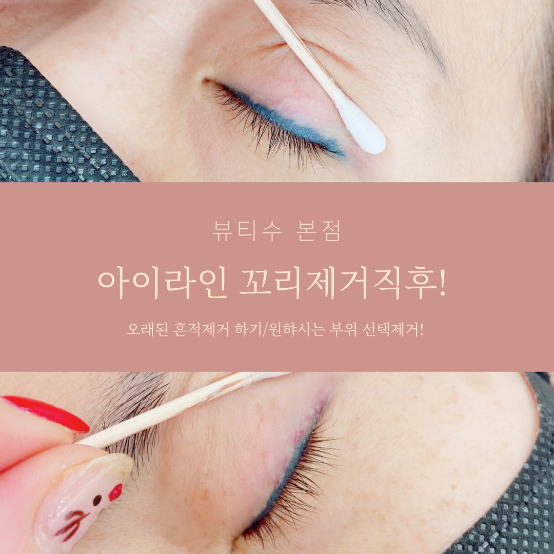 뷰티수
