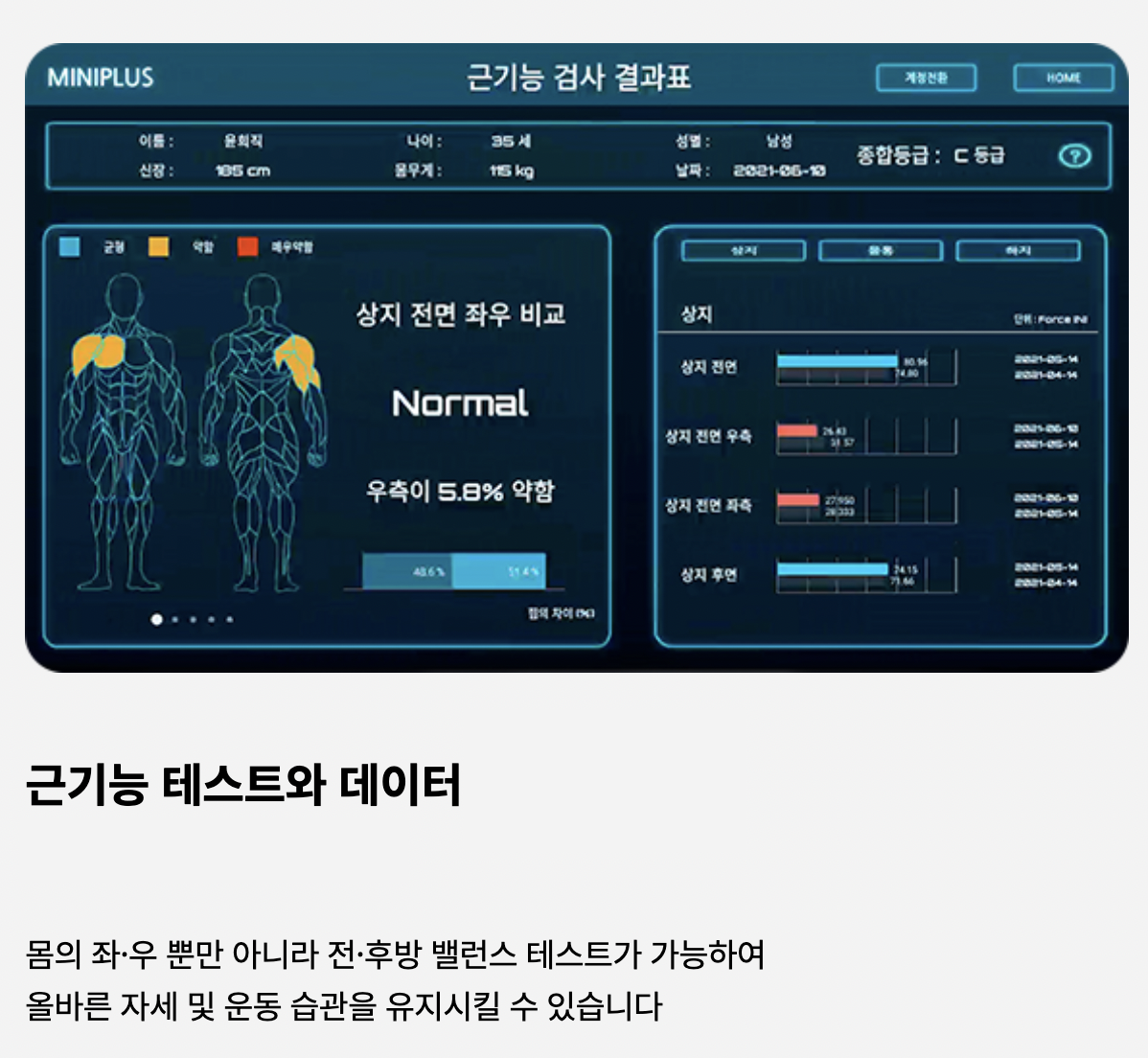 에이엠엘