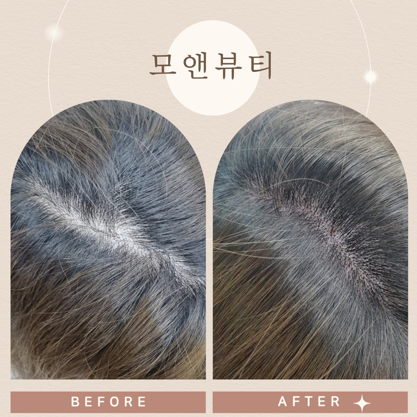 모앤뷰티SMP 대표 이미지