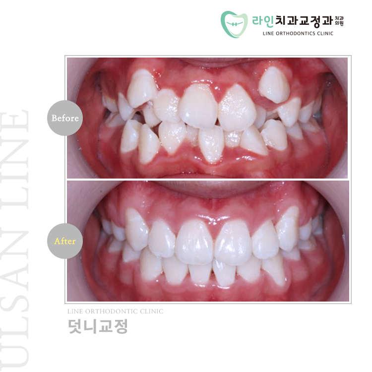 라인치과교정과치과의원 대표 이미지