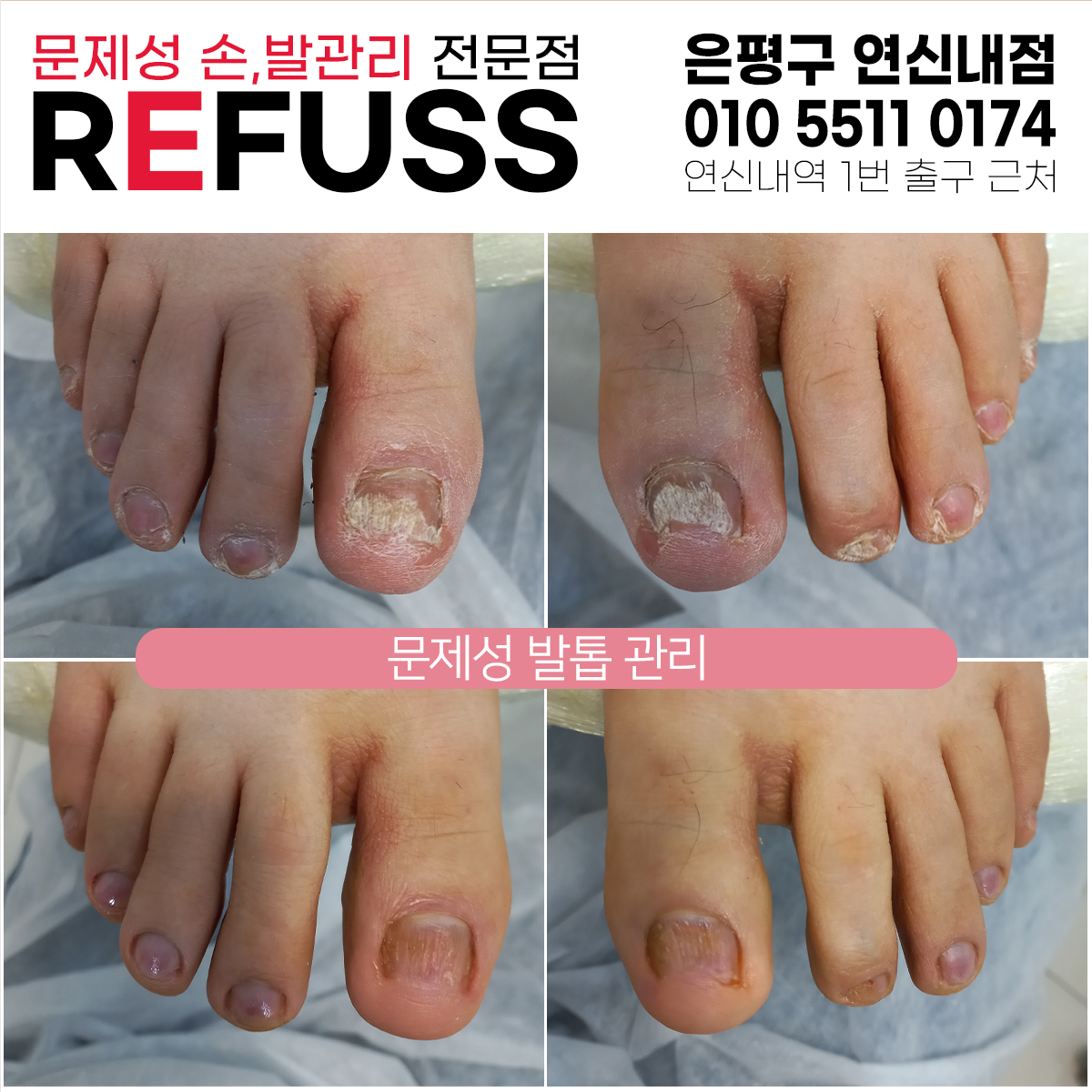 레푸스 연신내점