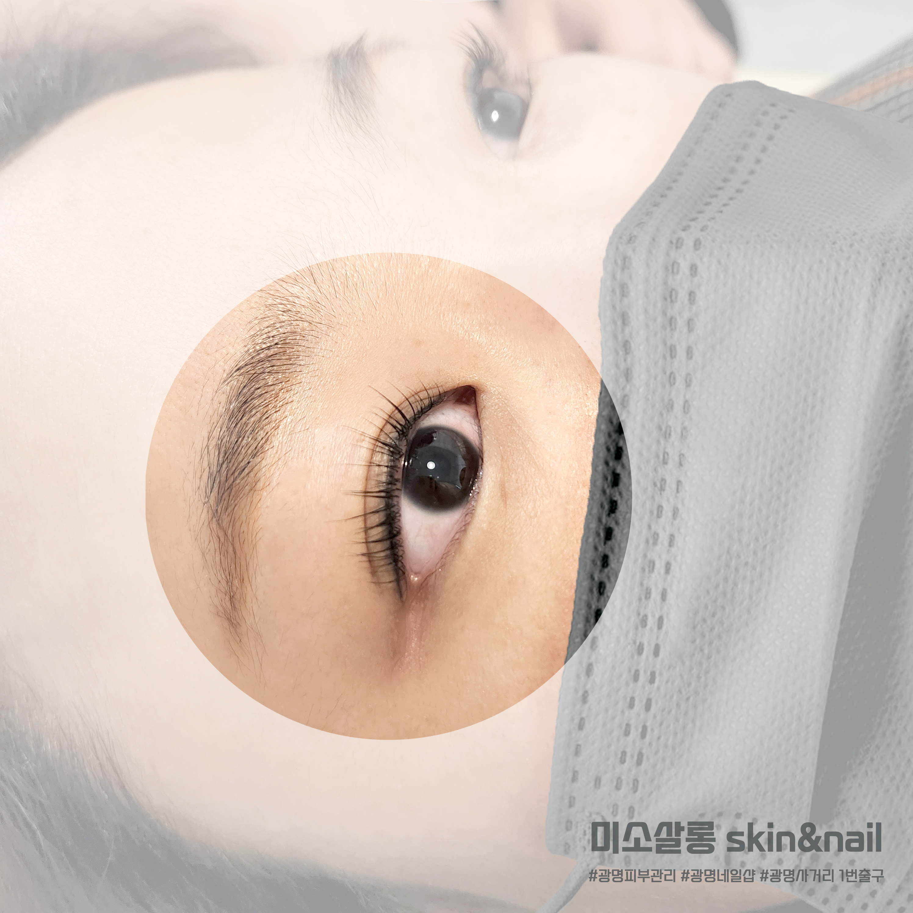 닥터아이티엔 미소살롱