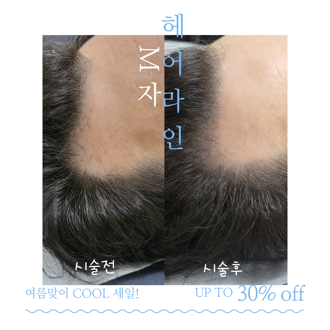 더채움 두피 SMP 대표 이미지