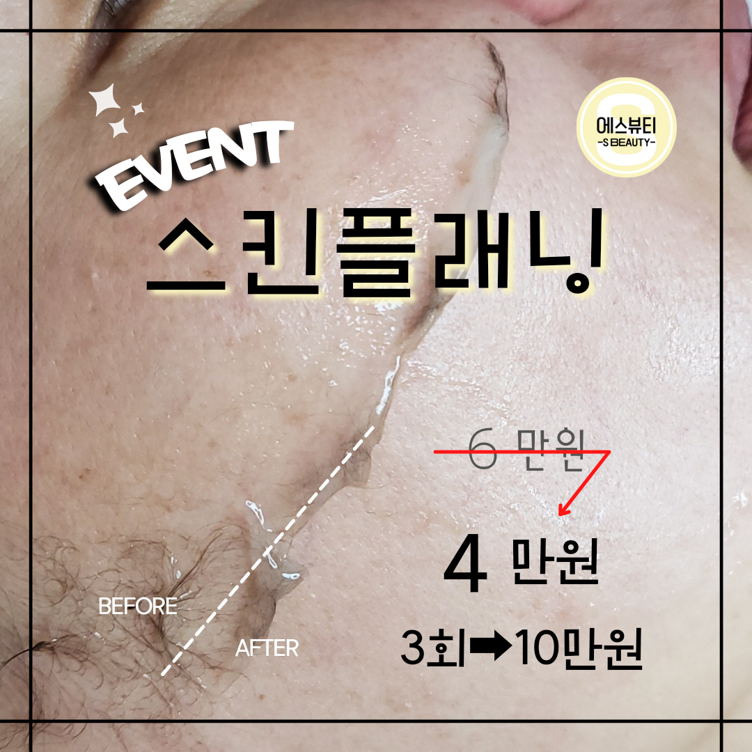 에스뷰티
