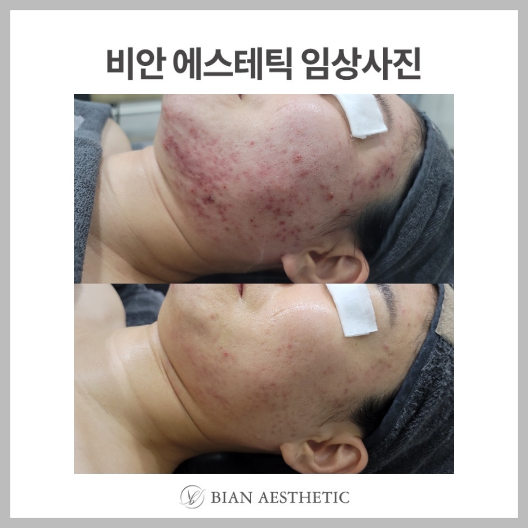 비안에스테틱