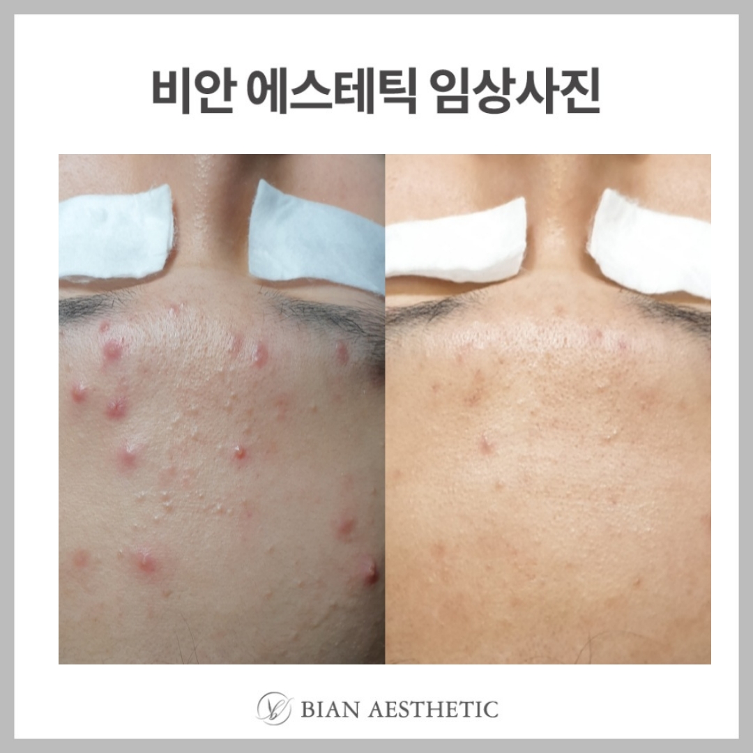 비안에스테틱