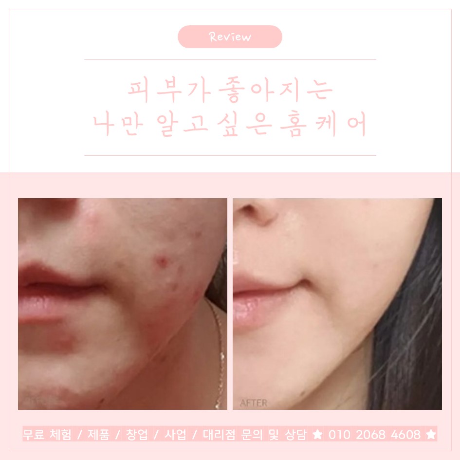 영뷰티랩 대표 이미지