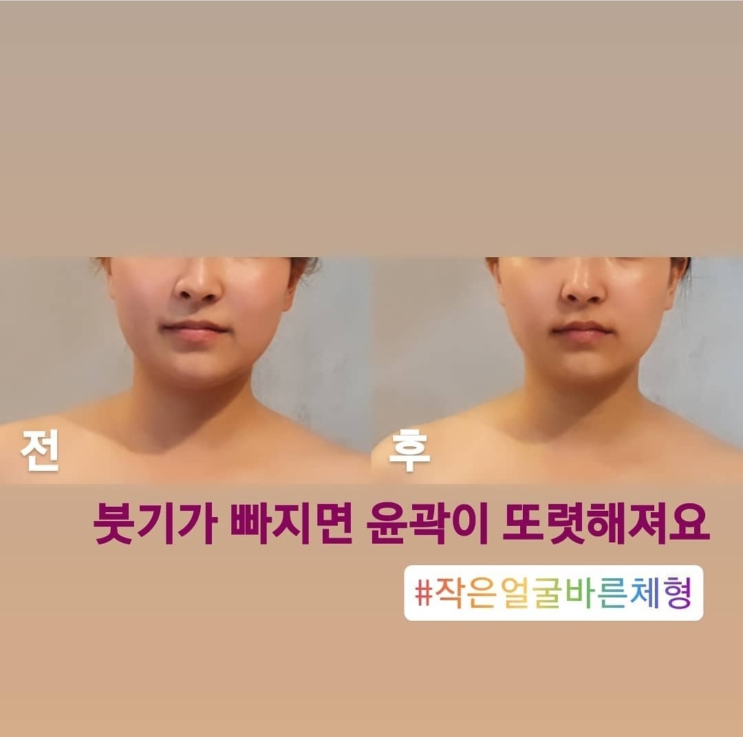 작은얼굴바른체형