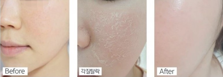 마이스킨테라피