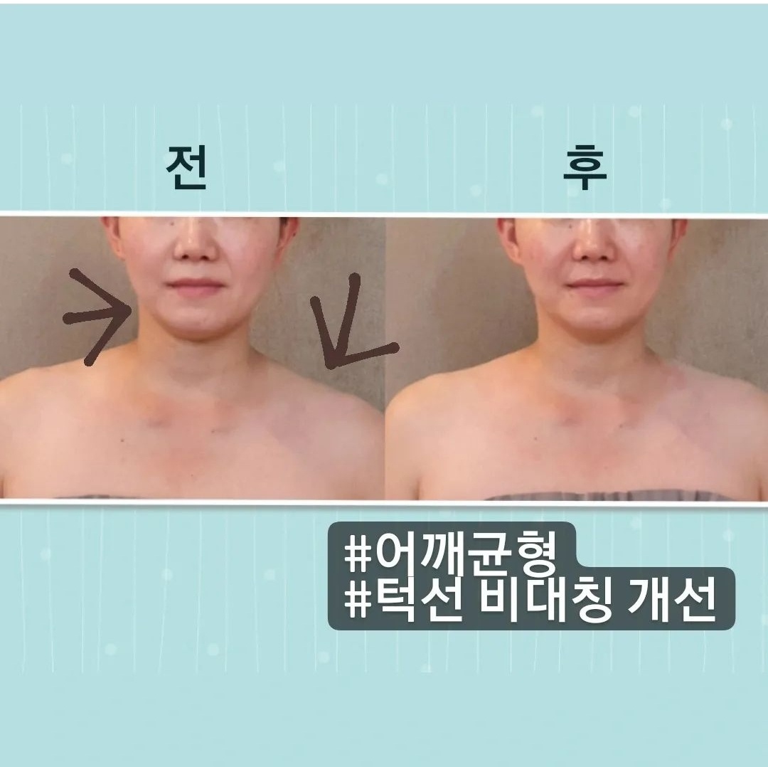 작은얼굴바른체형