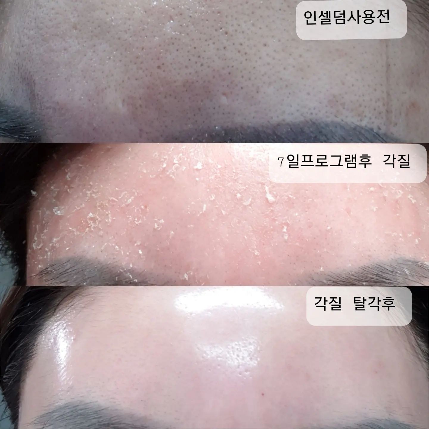 영앤리치 인셀덤 photo 2