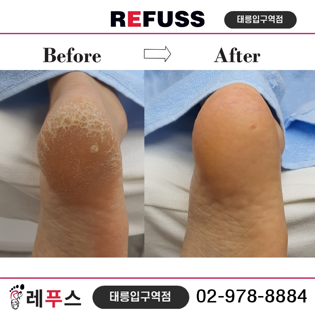 레푸스 태릉입구역점