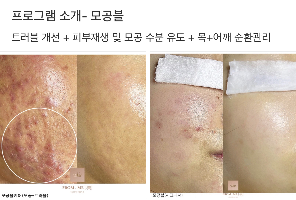 프롬미 분당점