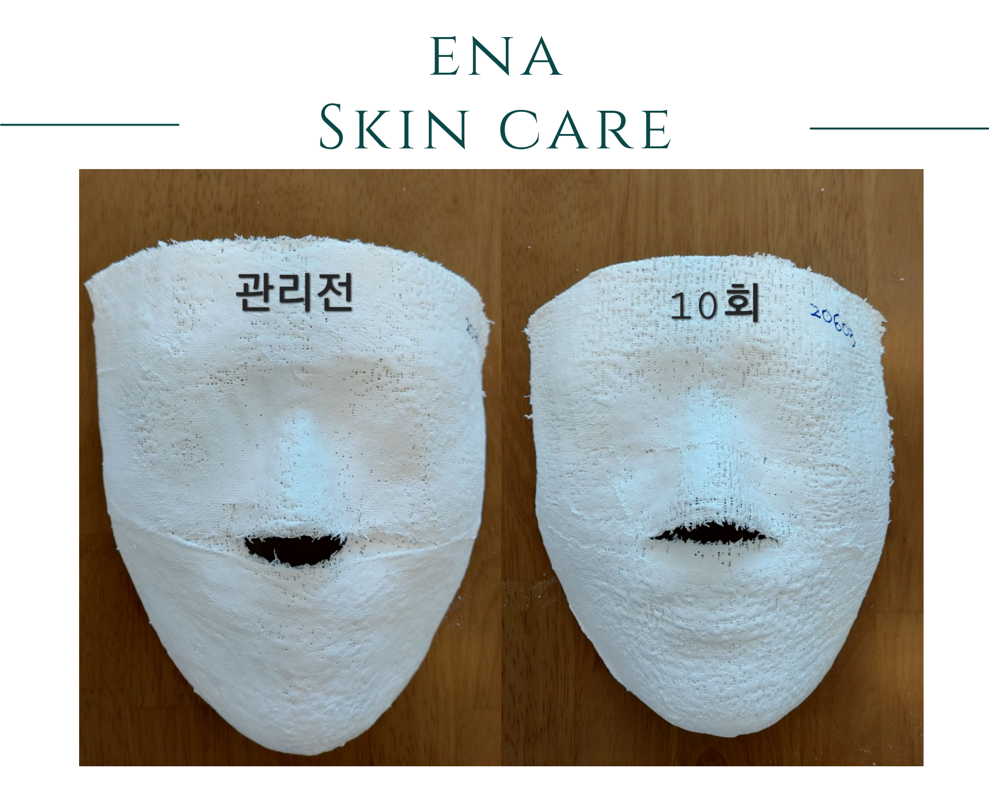 에나스킨케어 대표 이미지