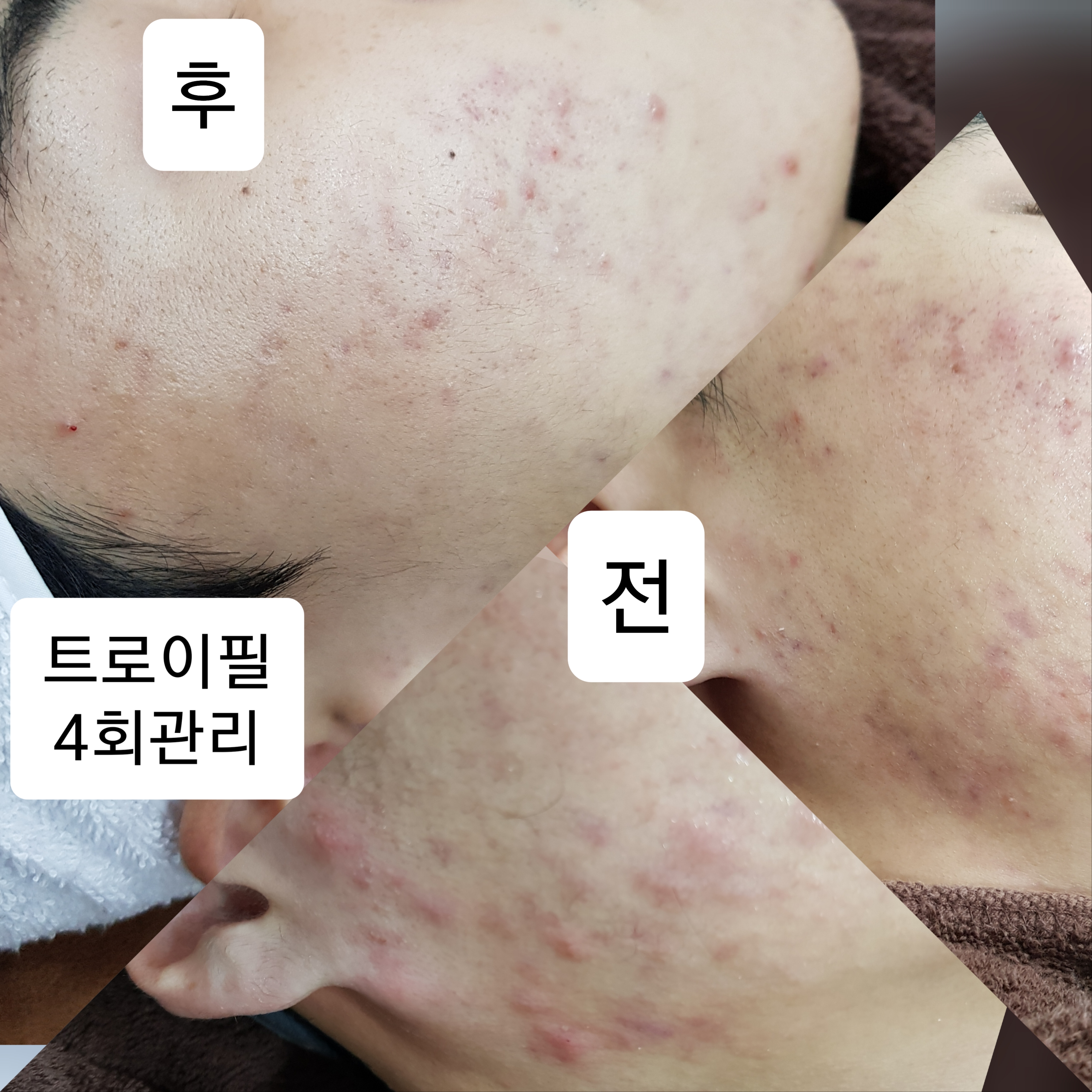 손길에스테틱 남악점