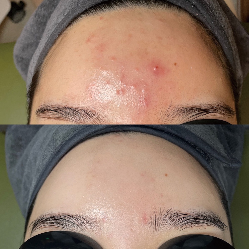 숲테라피 가산점 대표 이미지