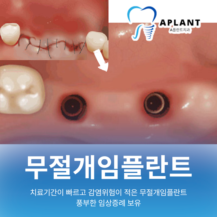 A플란트치과의원 대표 이미지