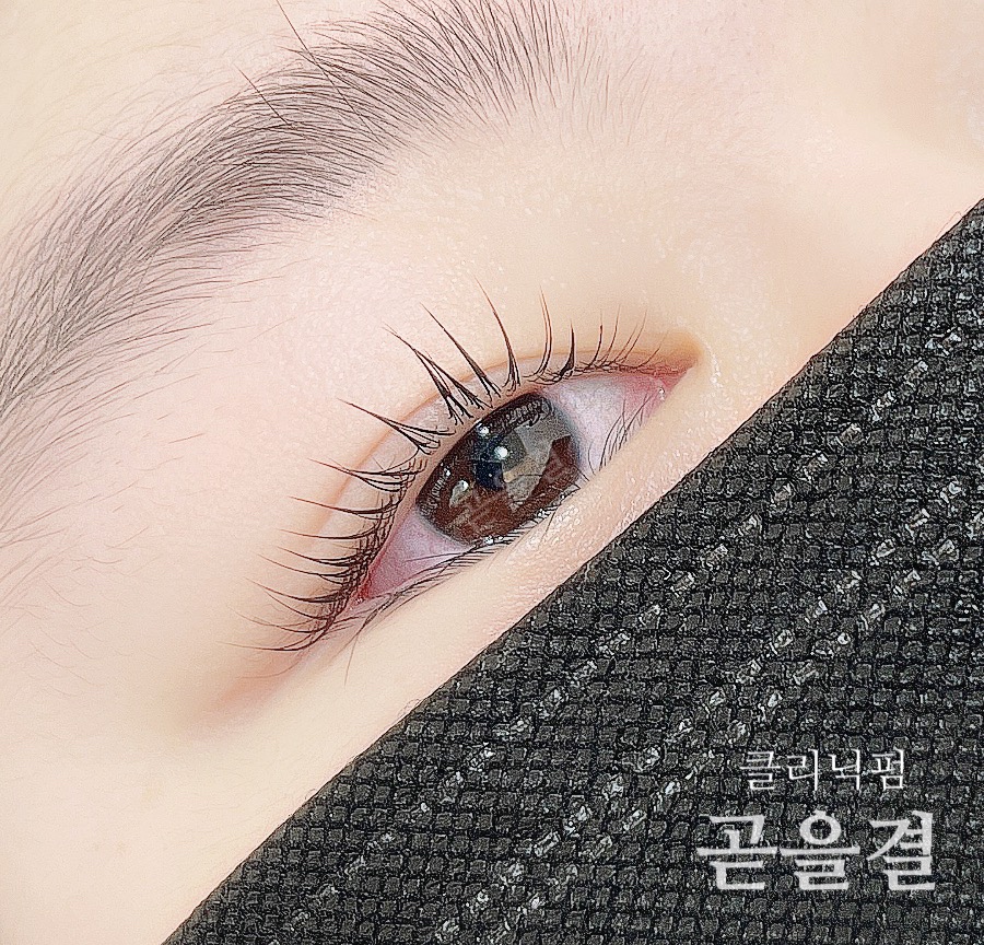 곧을결