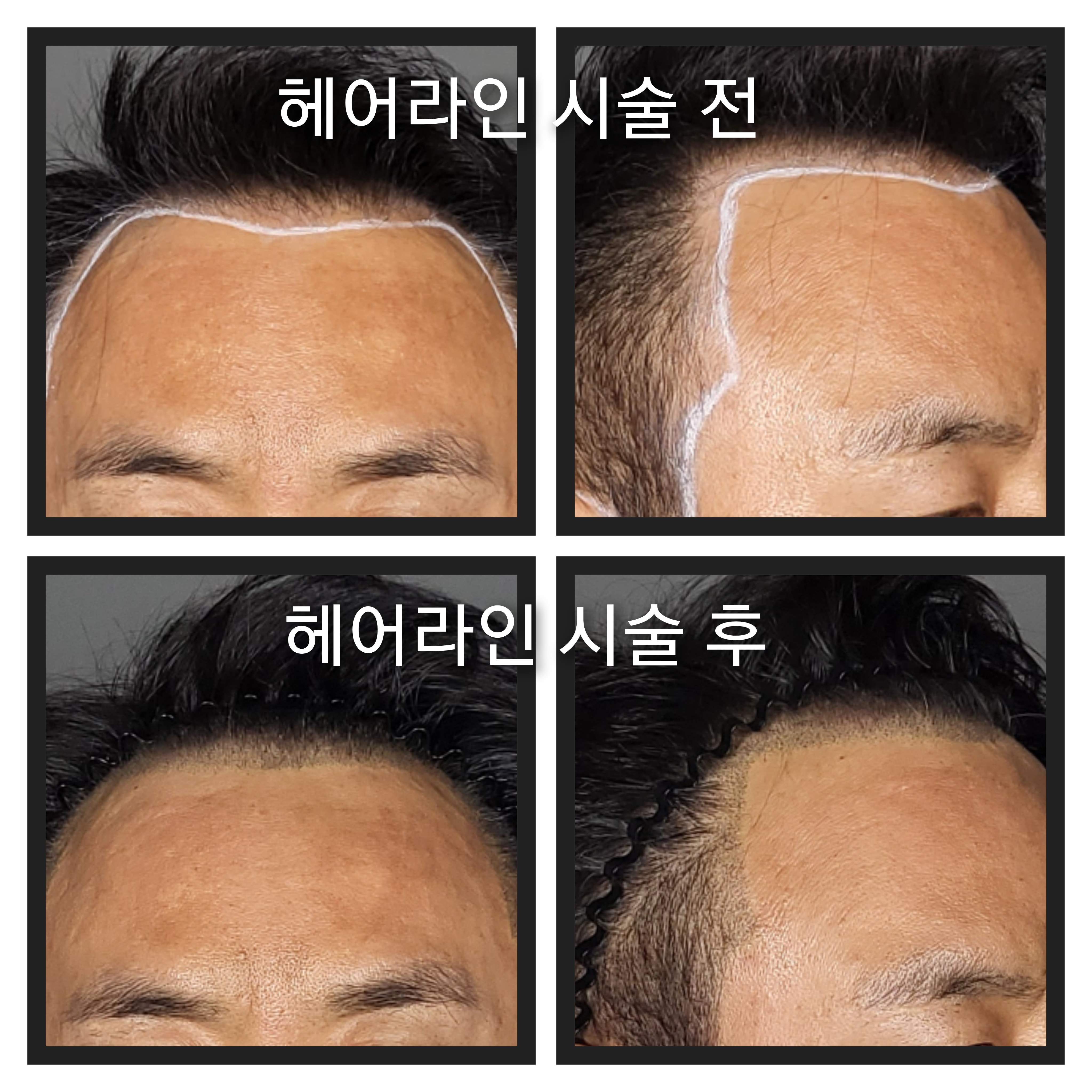 채움 대표 이미지