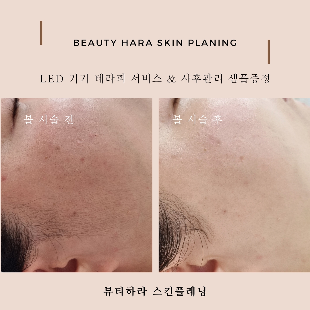 뷰티하라
