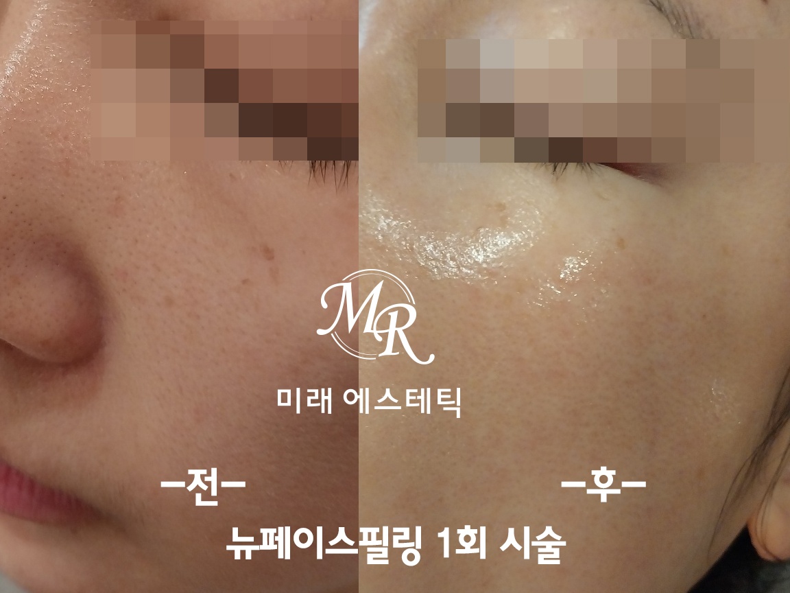 미래에스테틱 대표 이미지
