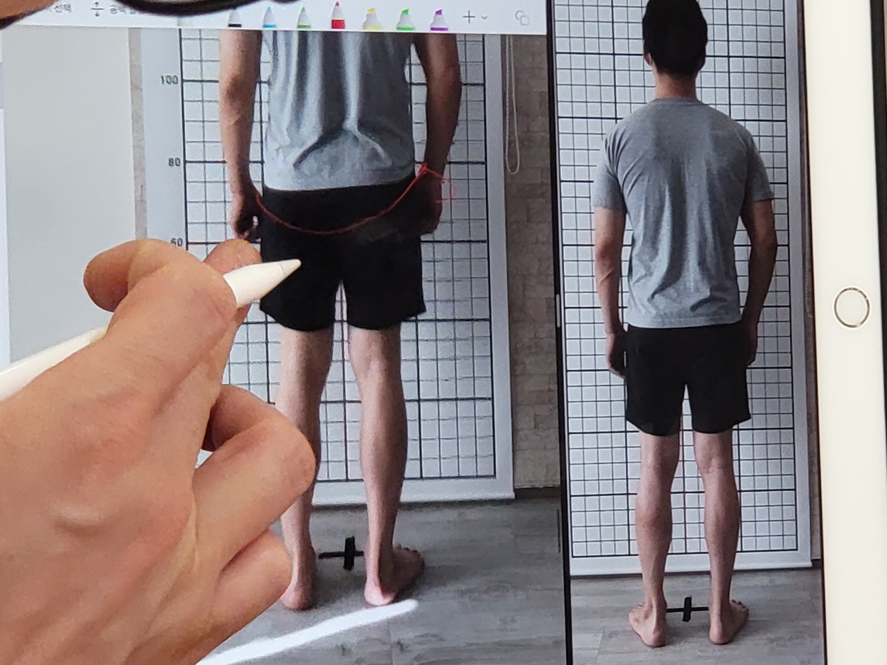 바른척추운동센터.재활운동.재활pt.체형교정