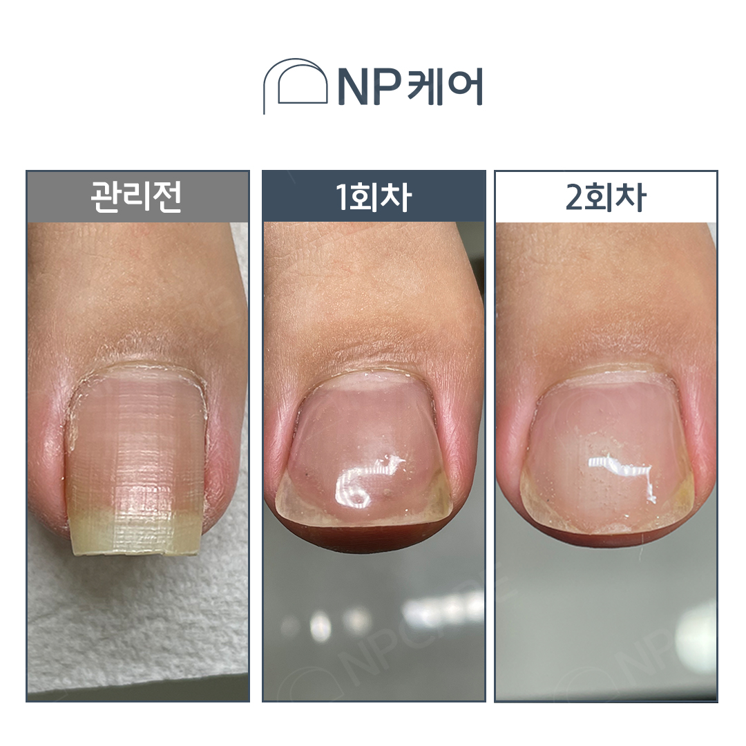 엔피케어 인천서창점 대표 이미지