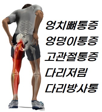 바른척추운동센터.재활운동.재활pt.체형교정