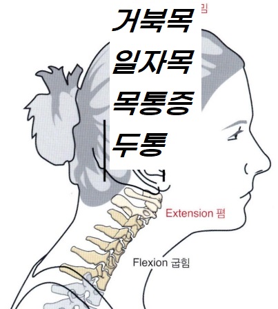 바른척추운동센터.재활운동.재활pt.체형교정