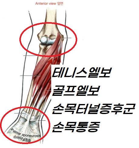 바른척추운동센터.재활운동.재활pt.체형교정
